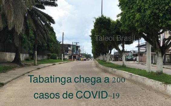 image for Tabatinga chega a 211 casos de COVID-19